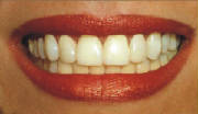 oralplus the most effective dentrifice BUY IT NOW